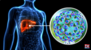 Pakistan moves closer to launching a new therapy for Hepatitis Delta, highlighting progress in advanced liver disease treatment.
